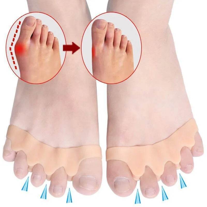 CozyStep™ Toe Separator: Say Goodbye to Hallux Valgus! - Image 10
